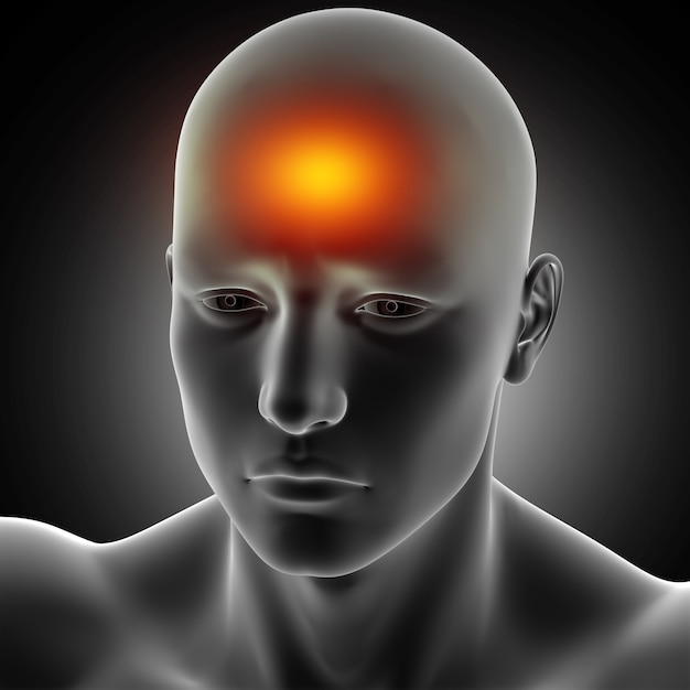 Free photo 3d render of a male medical figure with headache