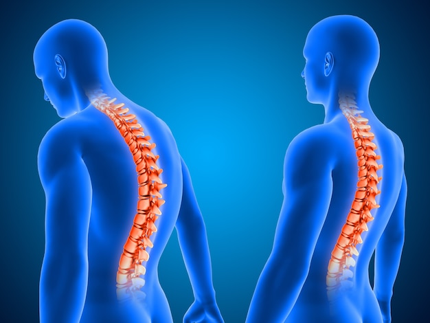 Free photo 3d render showing correct and poor posture with spine highlighted