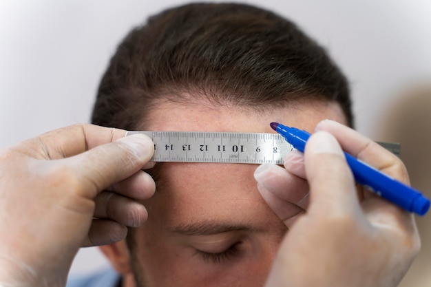 Adult male doing a follicular unit extraction