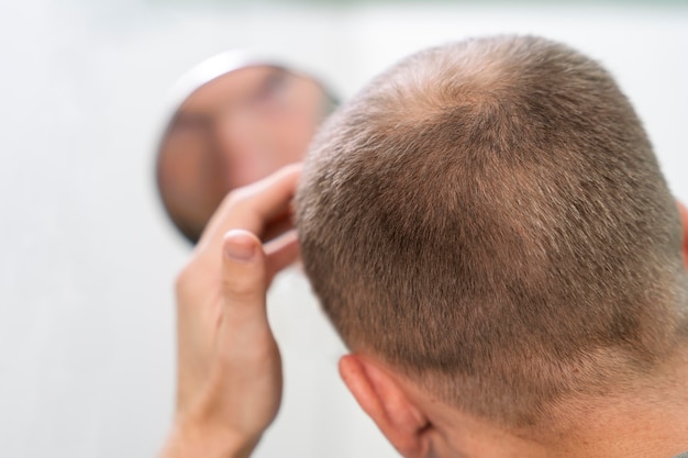 Free photo adult male having balding problems