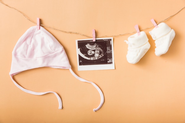 Free photo baby's cap; ultrasound picture and pair of woolen shoes hanging on clothesline against an orange backdrop