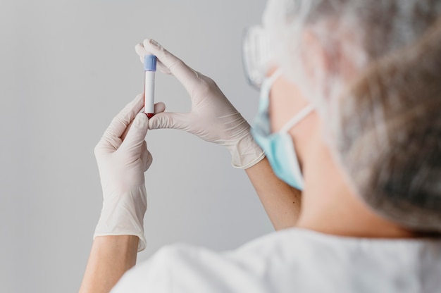 Free photo back view doctor holding a blood sample