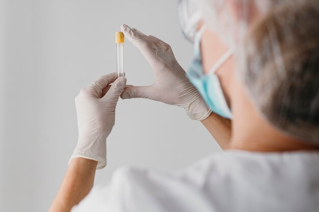 Back view doctor holding a blood sample