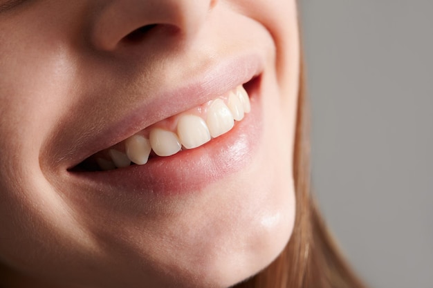 Beautiful female smile with white straight teeth