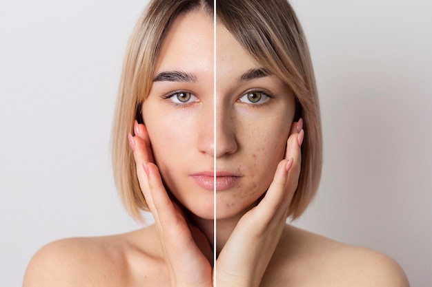 Before and after portrait of woman retouched