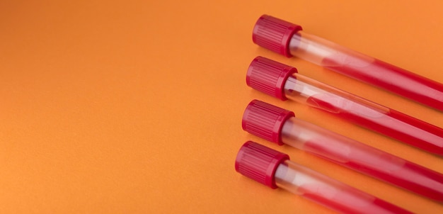 Blood samples assortment on orange