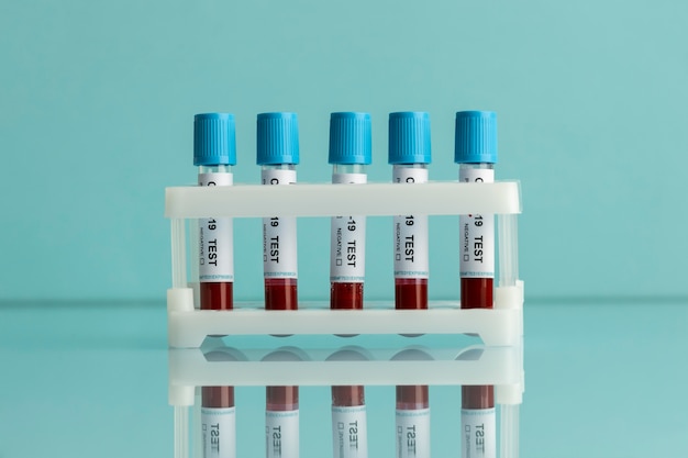 Blood samples for covid test in lab