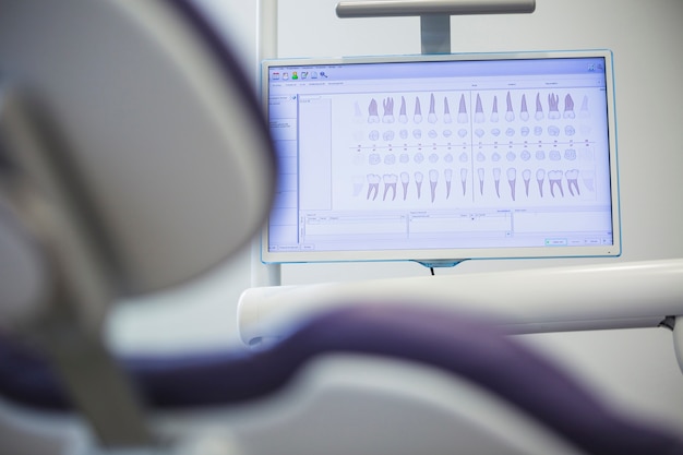 Free Photo close-up of dentition chart on monitor screen