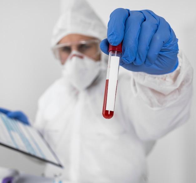 Close-up doctor holding covid sample