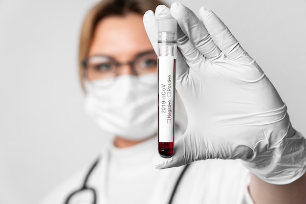 Free photo close-up doctor holding dangerous medical sample