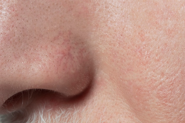 Free Photo close up on face pores texture