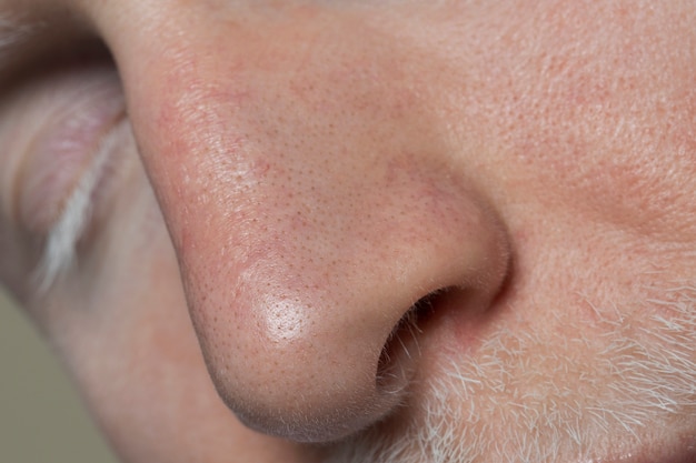 Close up on face pores texture