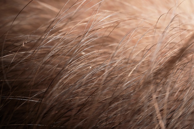 Free photo close up scalp with problems