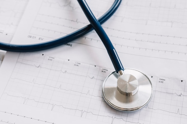 Close-up of stethoscope on cardiogram chart