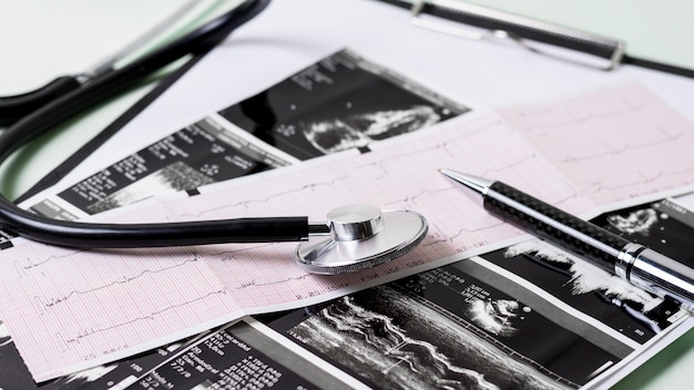 Close-up of stethoscope with other medical elements