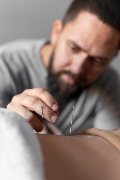 Free photo close-up therapist holding acupuncture needle