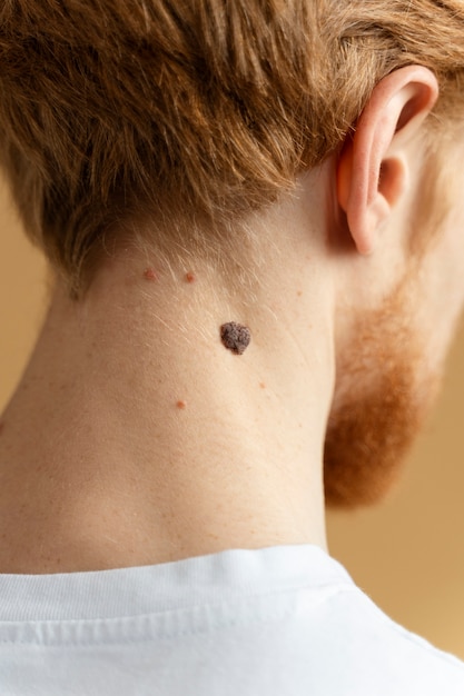 Free Photo close up young man with mole on neck