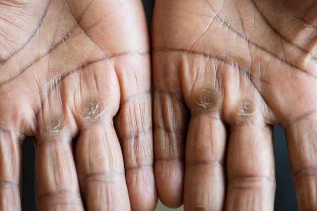 Free photo closeup of calloused black hands