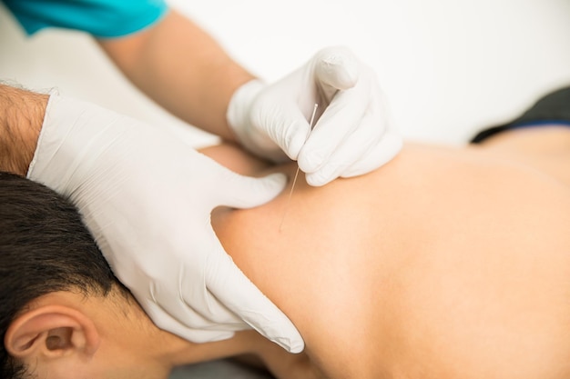 Free photo closeup of shirtless man receiving dry needling therapy from doctor in clinic