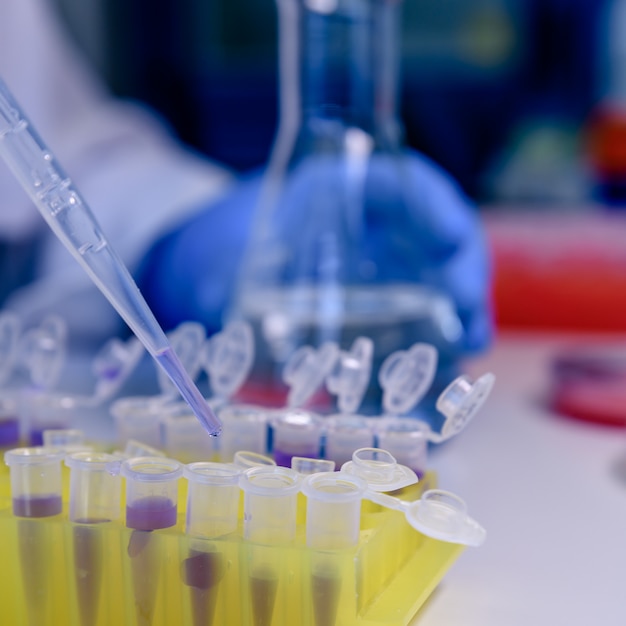 Closeup shot of a person doing a coronavirus test with pipettes