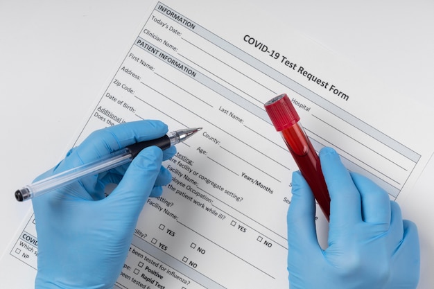 Coronavirus blood sample arrangement in lab