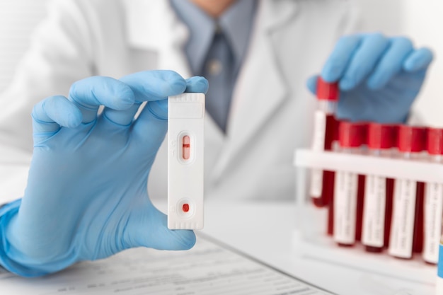 Free photo coronavirus blood samples arrangement in lab