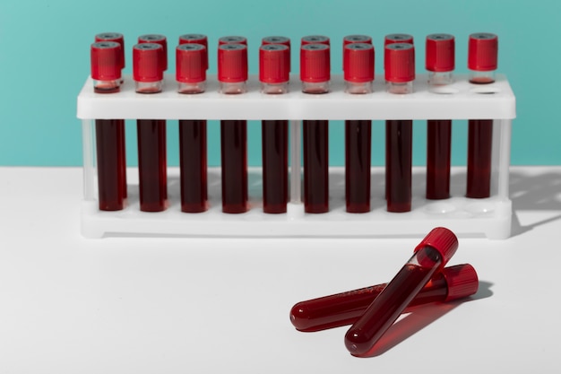 Free Photo coronavirus blood samples assortment in lab