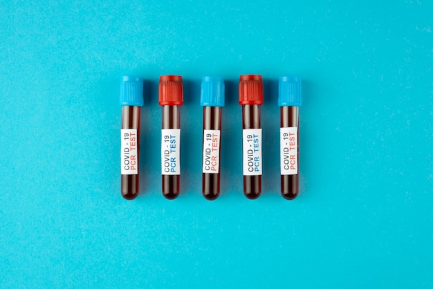 Free Photo coronavirus pcr tests arrangement flat lay