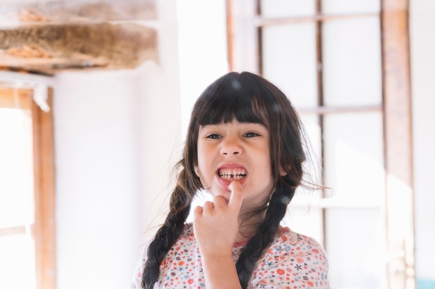 Cute girl showing her broken teeth