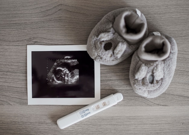 Cute little shoes and x ray photo