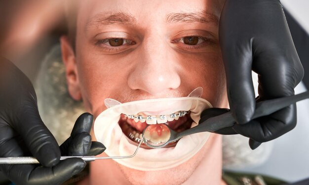 Dentist examining man teeth with dental explorer and dental mirror