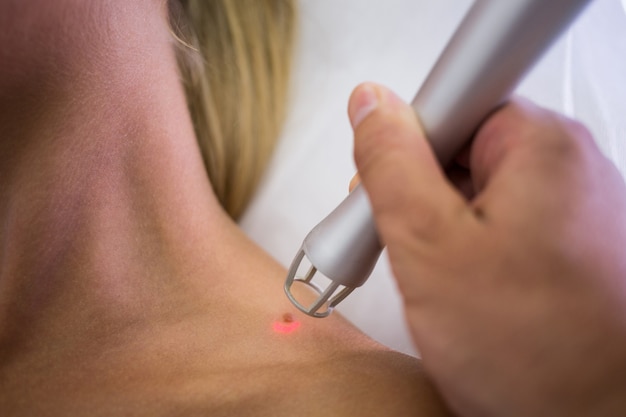 Free photo dermatologist removing mole from womans shoulder