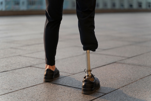 Disabled person with amputee leg