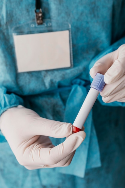 Doctor holding a blood sample