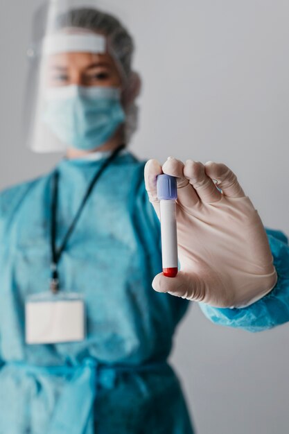 Doctor holding a blood sample