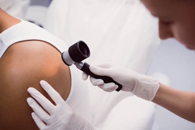 Doctor removing mole with laser treatment