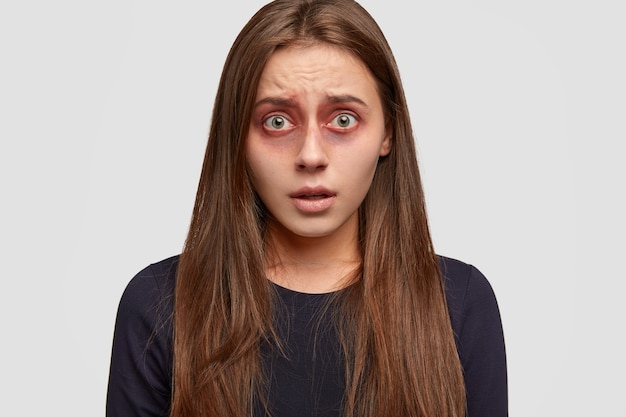 Free photo frightened young woman with bruises posing against the white wall