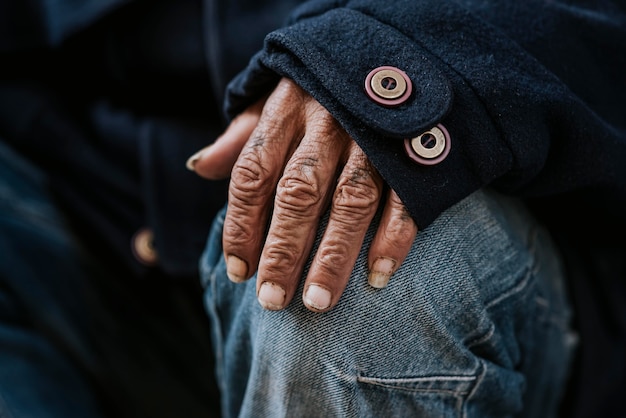 Front view of malnourished homeless man's hand