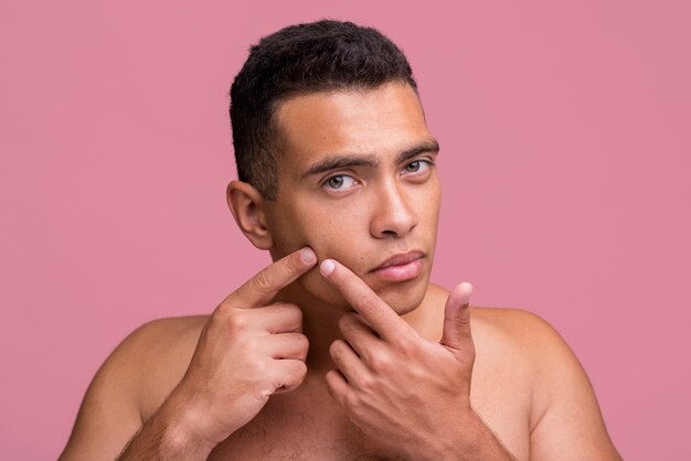 Front view of man trying to pop pimple on his face