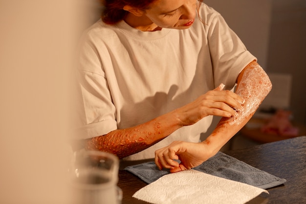 Free Photo front view woman experiencing skin disease