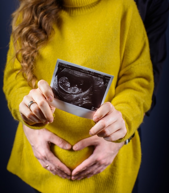 Free photo front view of woman holding ultrasound image