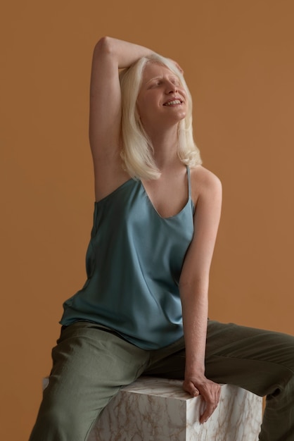 Free photo front view woman with albinism posing in studio