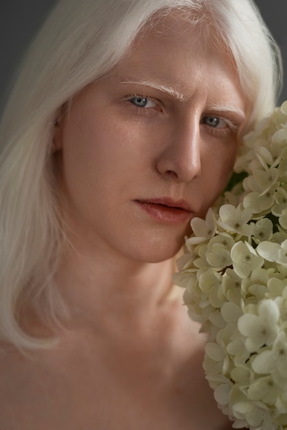 Free photo front view woman with albinism posing in studio