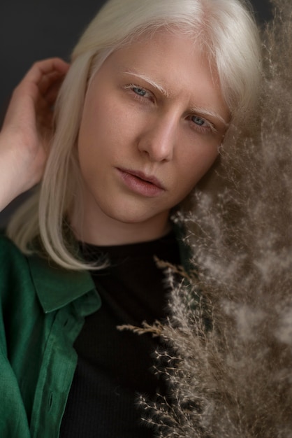 Free photo front view woman with albinism posing in studio