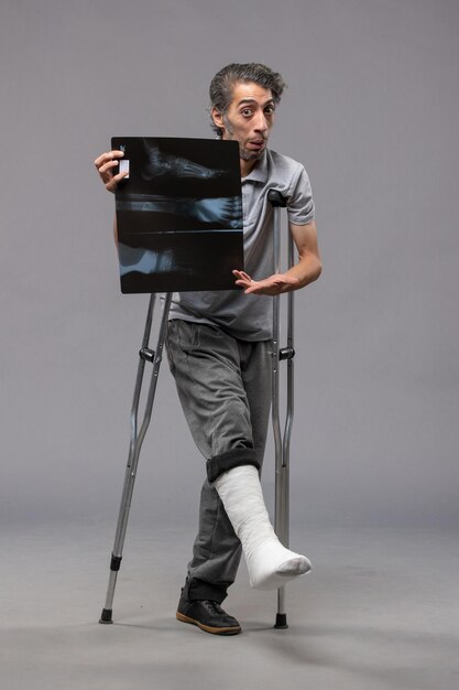 Front view young male with broken foot using crutches and holding his x-ray on grey wall disabled broken accident pain foot twist