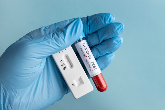 Hand with protective gloves holding a blood sample for covid test