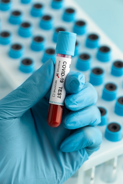 Hand with protective gloves holding a blood sample for covid test