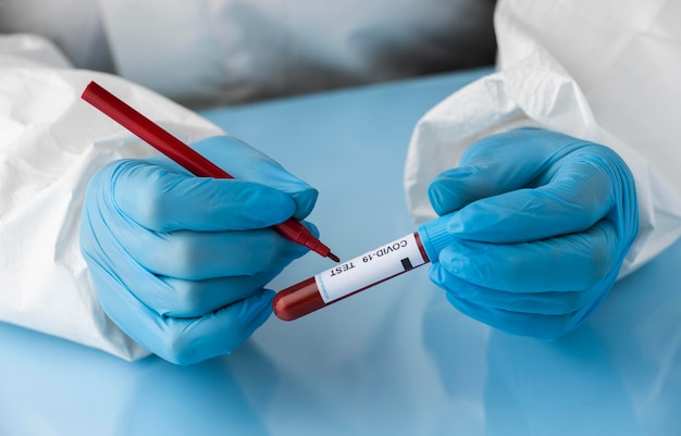 Free photo hand with protective gloves holding a blood sample for covid test