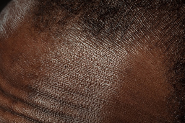 Head, face. Detailed texture of human skin. Close up shot of young african-american male body. Skincare, bodycare, healthcare, hygiene and medicine concept. Looks beauty and well-kept. Dermatology.