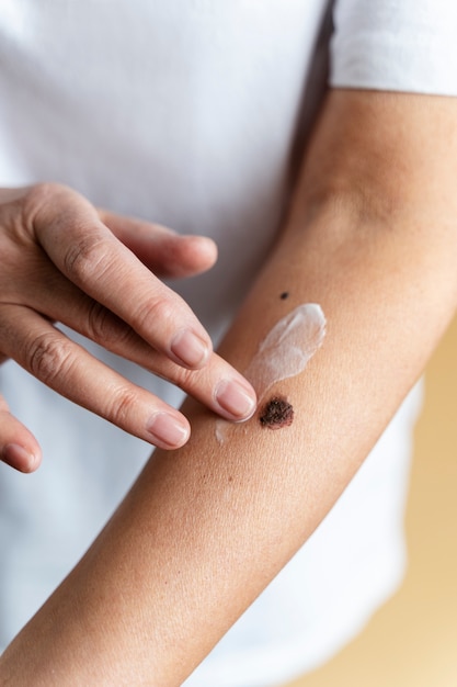 High angle hand applying cream on arm